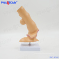 PNT-0748 Oesophagus pathology model esophageal anatomy